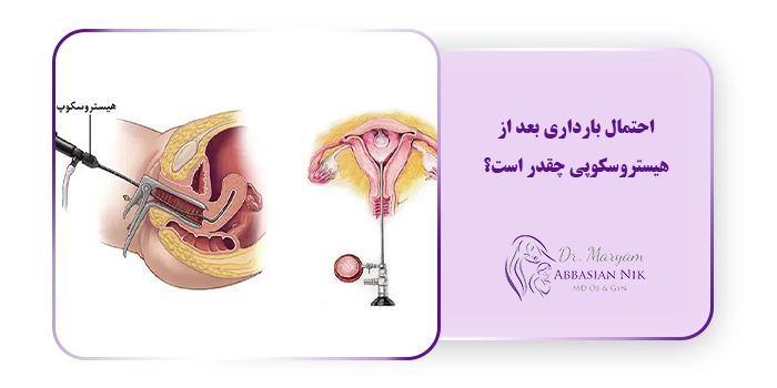 احتمال بارداری بعد از هیستروسکوپی چقدر است؟