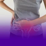 اندومتریوز در محل سزارین