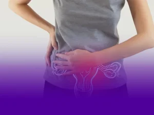 اندومتریوز در محل سزارین