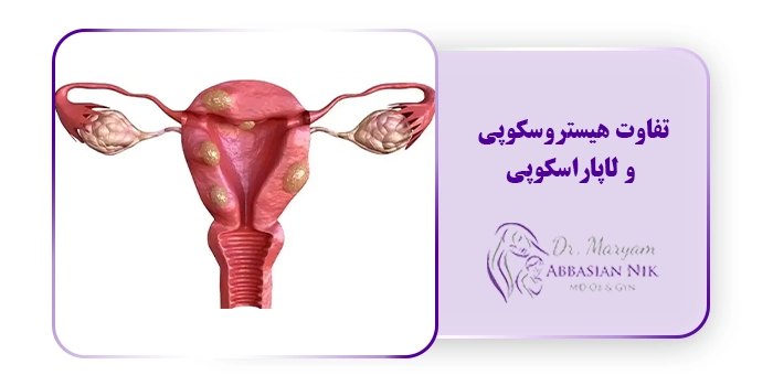 تفاوت هیستروسکوپی و لاپاراسکوپی