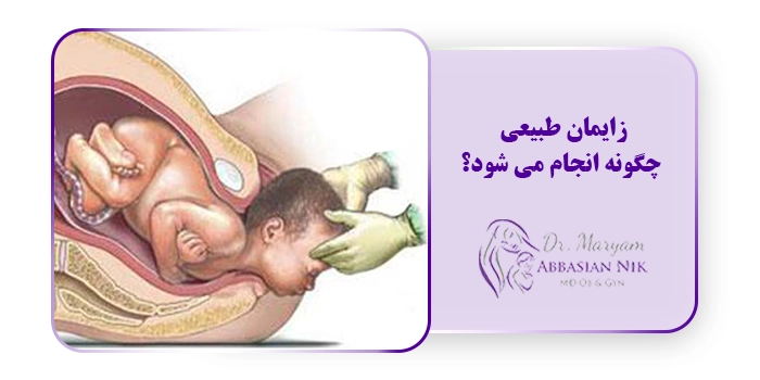 زایمان طبیعی چگونه انجام می شود؟