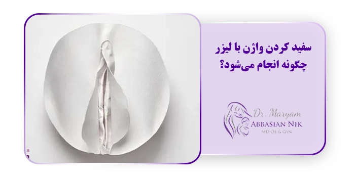 سفید کردن واژن با لیزر چگونه انجام می‌شود؟