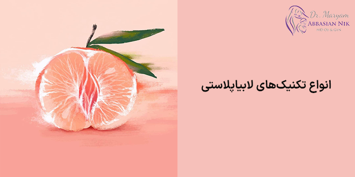 انواع تکنیکهای لابیاپلاستی