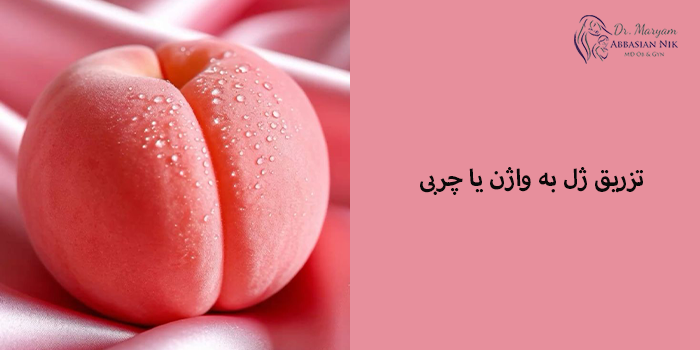 تزریق ژل به واژن یا چربی